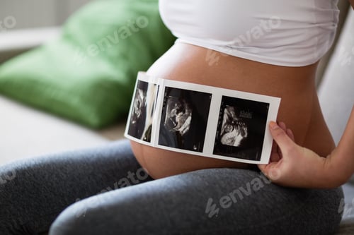 Preview: Pregnant woman expecting newborn