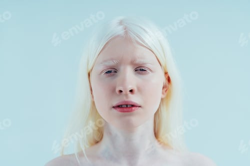 Preview: Beauty image of an albino