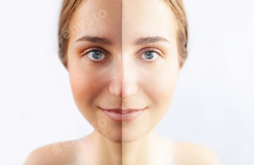 Preview: Tan. Half face tanned.. Woman skin before and after tan lotion or spray.