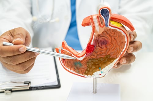 Preview: Stomach disease, doctor with human anatomy model for study diagnosis and treatment in hospital.