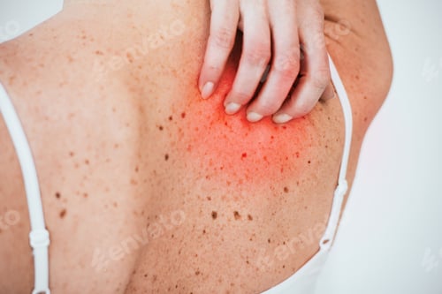 Visualização: cropped view of allergic woman scratching red skin isolated on white