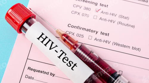 Preview: HIV virus, medical concept, Human Immunodeficiency Virus Positive test