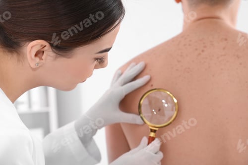 Preview: Dermatologist examining patient with magnifying glass in clinic, closeup view