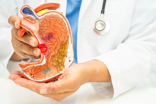 Preview: Stomach disease, doctor with anatomy model for study diagnosis and treatment in hospital.