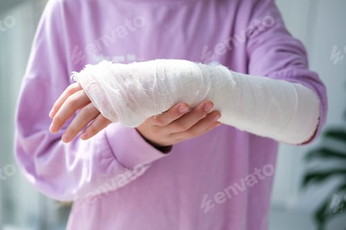Preview: Close-up of a broken arm of a child in a cast.