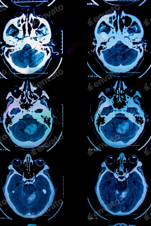 Preview: Radiology/ Medical Imaging