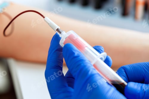 Vista previa: Hands of a doctor taking blood samples using a tube holder