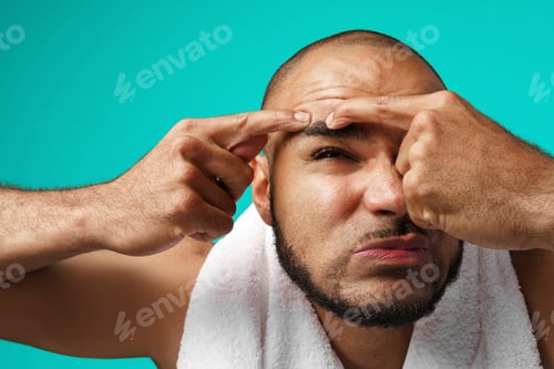 Preview: Close-up portrait of a black man squeeze a pimple on his face