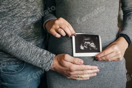 Preview: Stylish pregnant couple holding ultrasound scan of baby on baby bump