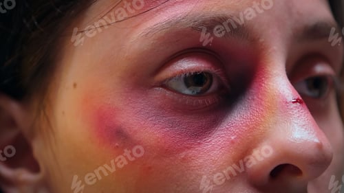 Preview: Close up of face with bruise
