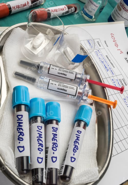 Preview: Tocilizumab and heparin medication for covid-19 patients with elevated blood dimero-D
