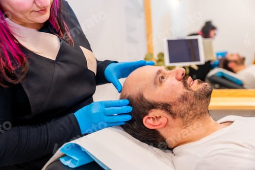 Preview: Dermatologist inspecting the bald man's head before a hair treatment