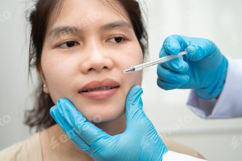 Preview: Asian woman receiving filler beauty injection.