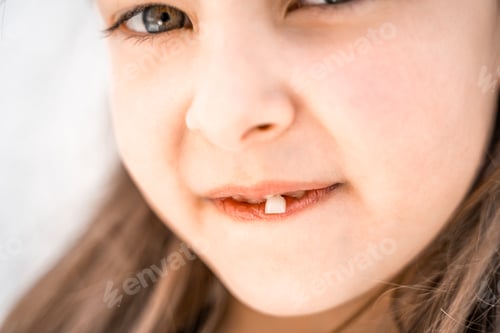 Preview: Charming smiling little girl kid with opened mouth shows staggering loose falling out first baby