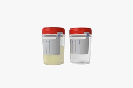 Preview: Sterile Specimen Container with Lid & Urine