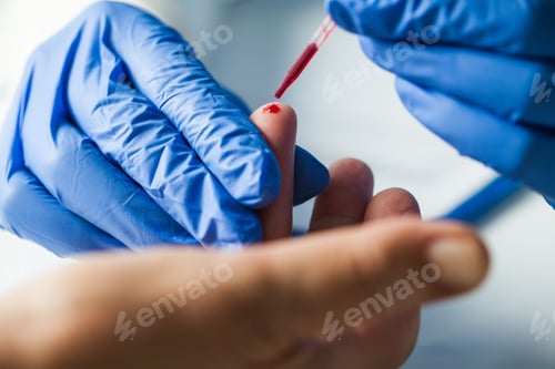Preview: Medical technician EMS doctor taking finger prick PRP patient blood sample using pipette