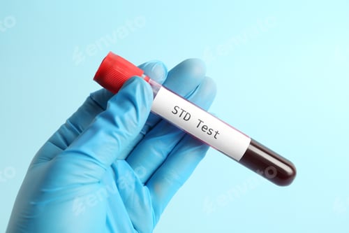 Preview: Scientist holding tube with blood sample and label STD Test on light blue background, closeup
