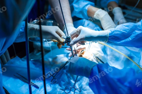 Preview: Medical Team Performing Surgery in Hospital Operating Room