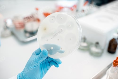 Vista previa: Bacterias con antibióticos en placas de Petri