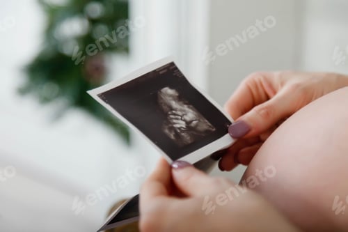 Preview: Woman pregnant with twins in hand an ultrasound scan of her babies