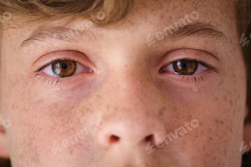 Preview: Crop crying child with freckles on face skin