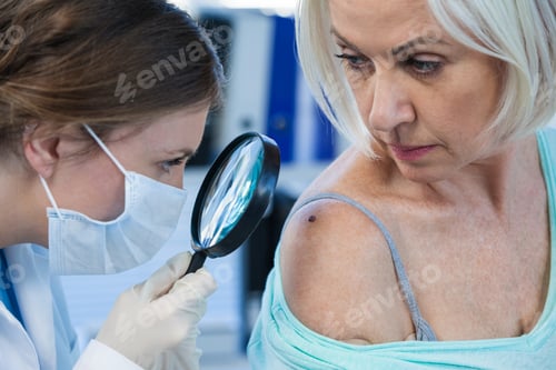 Preview: Dermatologist examining mole of female patient with magnifying glass