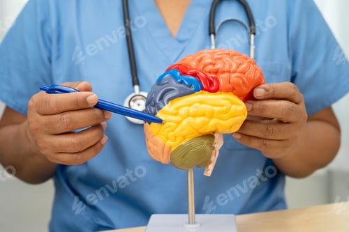 Preview: Alzheimer disease, Asian doctor holding brain anatomy model