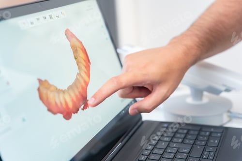 Preview: A doctor in the dental clinic explaining and looking at the 3d of the x-ray on the computer