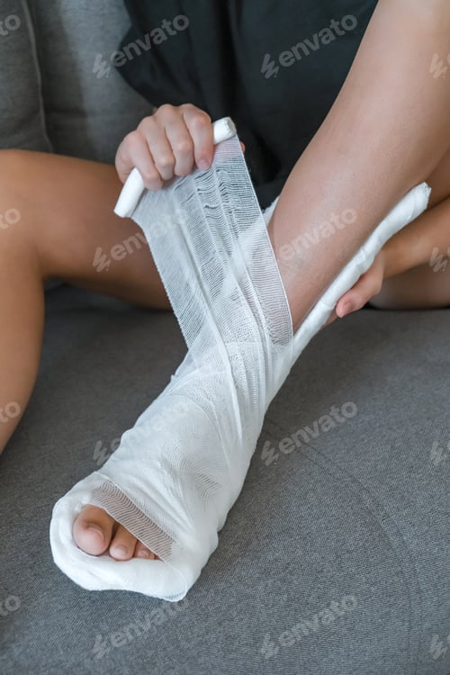 Preview: woman with Plastered Leg in a cast is recovering at home.
