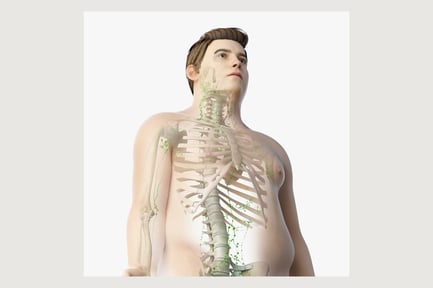 Obese Male Anatomy: Skin, Skeleton, and Lymphatic System