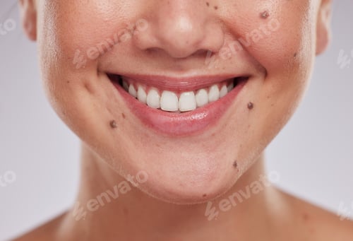 Preview: Closeup, teeth and woman with dental care, cosmetics and treatment against grey studio background.