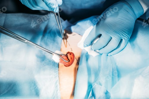 Preview: Surgical Tools and Tissue During Medical Procedure