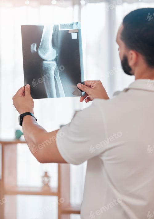 Preview: Man, physiotherapist and x ray scan analysis in sports clinic for broken bone check, healthcare wel