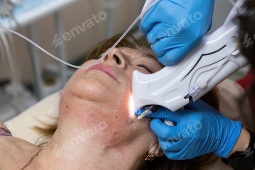 Preview: Carboxytherapy of fat deposits on the chin. Rejuvenation of the facial skin with carbon dioxide. Cor