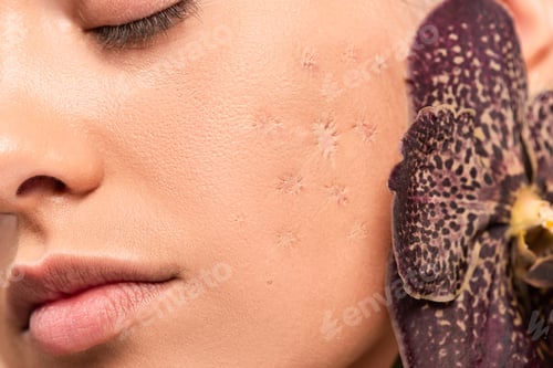 Preview: close up of orchid near woman with problem skin and closed eyes isolated on beige