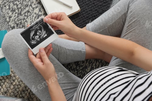 Preview: Pregnant woman holding ultrasound photo of baby, top view