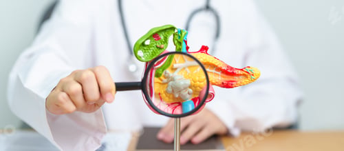 Preview: Doctor with human Pancreatitis anatomy model with Pancreas
