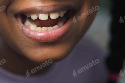Preview: Child smiles brightly showcasing missing teeth during play