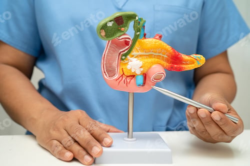 Preview: Pancreatitis, pancreatic cancer, Asian doctor with pancreas, gallbladder and bile duct human