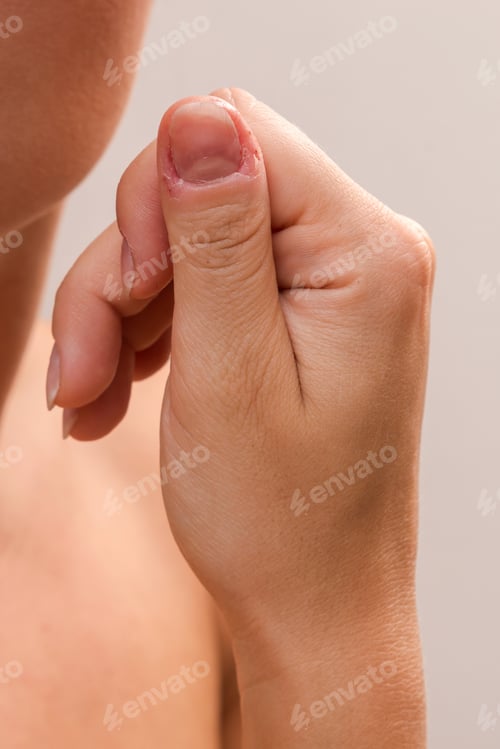 Preview: Closeup of injured female finger after biting nails