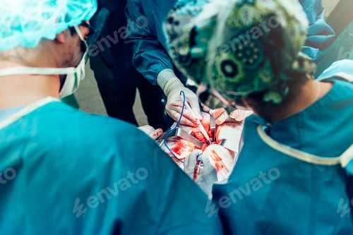 Preview: Team of Surgeons Operating.