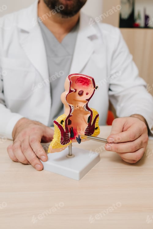 Preview: Rectum model with pathologies used for healthcare education and training.