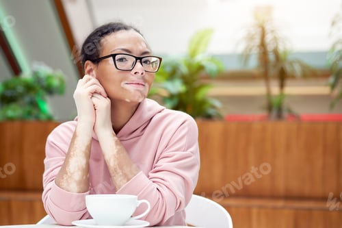 Preview: Black african american woman with vitiligo pigmentation skin problem indoor dressed pink hoodie