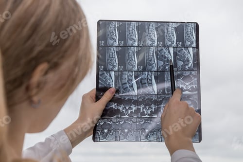 Preview: The doctor examines the result of an MRI of the spine