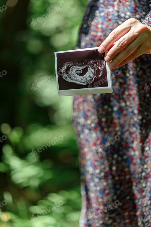 Preview: A young woman in shade of forest shows result of ultrasound against background of a pregnant belly