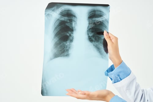 Preview: X-ray diagnosis radiologist profession hospital
