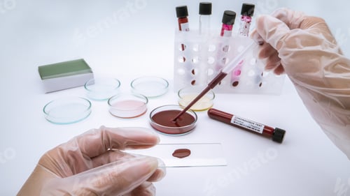 Preview: Experimented in laboratory with pipette adding coronavirus infected blood