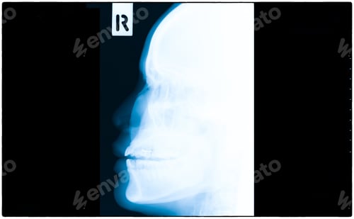 Preview: X-Ray film scan of human.