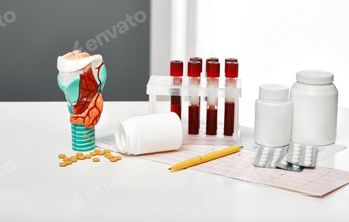 Preview: Thyroid disease diagnostic. Anatomical model of the thyroid gland, blood for analysis in test tubes