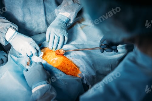 Preview: Surgical Team Performing Operation in Hospital Setting